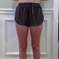 American Eagle Outfitters Shorts | American Eagle Striped Shorts (Set) | Color: Black/White | Size: One Size