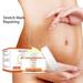 Travelwant 50g Mango Stretch Marks Scar Cream Stretch Marks Treatment Maternity Repair Recovery Elasticity Repair Scar Slack Line Abdomen Stretch Marks Postpartum