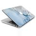 Marble Hard Case for Macbook Pro 13 -A1989/A2159/A1706/A1708/A1278/Pro 13 Retina-A1425/A1502/Air 13 -A1932/Air 13 -A2179/Air 13 -A1466/A1369/Pro 13 -A2251/2289