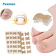 Pexmen – patchs correcteurs pour ongles incarnés 10/50/100/200 pièces autocollants pour orteils