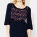 Free People Sweaters | Free People Abstract Floral Tunic Sweater Navy Size Extra Small | Color: Blue | Size: Xs