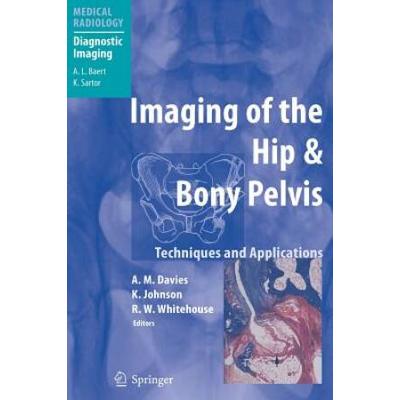 Imaging of the Hip & Bony Pelvis: Techniques and A...