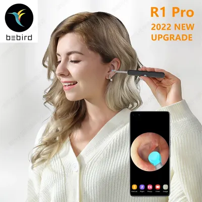 Bebird-R1 Smart Visual Ear Cleaner Sticks Endoscope Haute Précision Earpick Mini Caméra