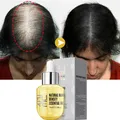 PURC huile de croissance des cheveux pour hommes femmes gingembre Anti perte de cheveux soin