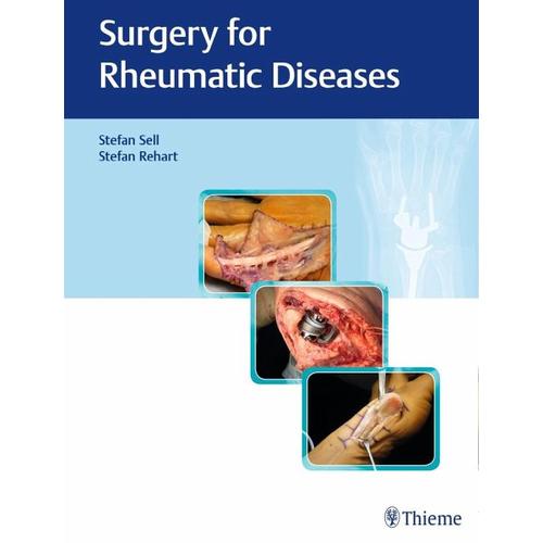Surgery for Rheumatic Diseases – Stefan Sell, Stefan Rehart
