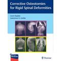 Rigid Spine Deformities - Leon Herausgegeben:Kaplan, Lawrence G. Lenke
