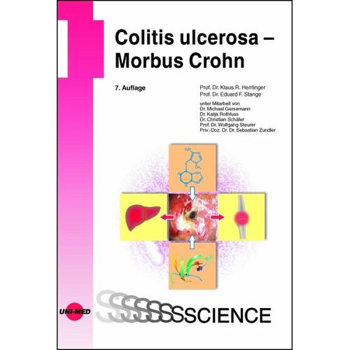 Colitis ulcerosa – Morbus Crohn – Klaus R. Herrlinger, Eduard F. Stange