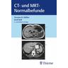 CT und MRT Normalbefunde - Torsten Bert Möller, Emil Reif