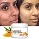 Turmeric Face Whitening Cream for Dark Skin Remove Acne Lighten Dark Spots Moisturizing Brightening