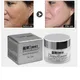 Dimollaure Whitening Freckle Cream Moisturize Firming Anti-Wrinkle Remove Dark Spots Melasma Melanin
