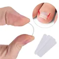 10pcs Ingrown Toenail Correction Tool Ingrown Toe Nail Treatment Elastic Patch Sticker Straightening