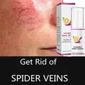 20ML Anti Redness Soluation Spider Vein Removal Advanced treatment Clearer skin Veins on Face