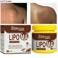 Lipoma Removal Cream Lipolysis Fat Lump Relief Cream Skin Swelling Fat Elimination Cream 20g Health