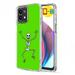 TalkingCase Slim Phone Case Compatible for Motorola Moto G Stylus 5G 2023 Skeleton Dance Print w/ Glass Screen Protector Light Weight Flexible Soft USA