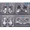 1/10 radio control car Accessories 4 styles light fixtures/light cup for 1/10 R/C hobby racing drift