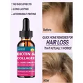 Hairloss Hair Alopecia Hair Treatment for Black Women Growth Oil Head Care Growth Spray