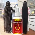 Siero per la crescita dei capelli Spray trattamento liquido per la crescita rapida dei capelli