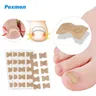 Pexmen 10/20/50/100Pcs adesivi per la correzione dell'unghia del piede incarnita Patch per il