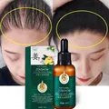 Ginger Hair Treatment Essential Oil Essence Original Genuine 100% Hair Loss Liquid Health and Beauty