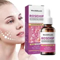 Rosehip Oil 30ml Natural Ordinary Rosehip Oil For Face Firming Facial Skin Care Serums Moisturizer