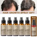 PURC Fast Hair Growth Oil Spray Hair Loss Scalp Treatment Bald Care Beauty for Men Women Grow Hair