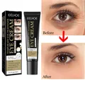 Anti Dark Circle Eye Cream Eye Bags Whitening Lightening VC Cream Wrinkle Removal Serum Eyes Firming