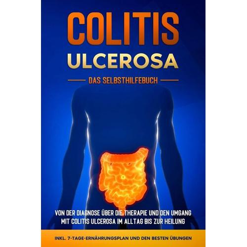 Colitis ulcerosa – Das Selbsthilfebuch: Von der Diagnose über die Therapie und den Umgang mit Colitis ulcerosa im Alltag bis zur Heilung – inkl. 7-Tag