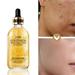 Daqian the Gold Nicotinamide Liquid 24K Gold Essence Muscle Bottom Liquid Rehydration Moisturizes 30ML Serum for Face Dark Spot Corrector Face Serum Anti Aging