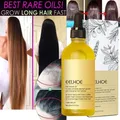 Olio naturale per la crescita dei capelli efficiente Anti perdita di capelli olio essenziale