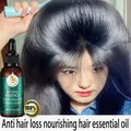 Capelli crescita rapida cura dei capelli olio essenziale zenzero naturale prodotti per la ricrescita
