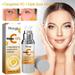 Weloille Vitamin C Serum for Face: Super C Face Serum with Vitamin C Vitamin E Vitamin B and Hyaluronic Acid for Dark Spots and Firming Wrinkles - Anti Aging Brightening Face Serum 30ml