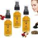 Chamoist Rosehip Oil Castor Oil Skin Fixx Oil Black Seed Oil-Miracle Facial Moisturizer Organic Natural Face Oil Anti-Aging Serum Natural Skincare - Hydrates Skin - Nourishing - Makes Skin Behave