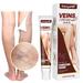 20g Leg Varicose Vein Massage Cream Leg Swelling Pain Relief Natural Ingredient Leg Swelling Pain Relief Health Product