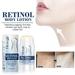 Fankiway Retinol Body Lotion Retinol Body Wand For Face And Body Anti Aging Body Lotion For Tightening Sagging Fine Lines Wrinkles Age Spots Scaly & Crepey Skin Beauty & Personal Care