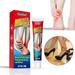 3 Pack Herbal Foot Heel Pain Ointment Rheumatism & Arthritis Pain Ointment Foot Sprain Analgesic Cream