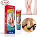 CozyHome 3 Pack Herbal Foot Heel Pain Ointment Rheumatism & Arthritis Pain Ointment Foot Sprain Analgesic Cream