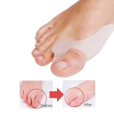1Pair Silicone Toes Separator Foot Hallux Valgus Correction Bone Ectropion Adjuster Toes Outer Appliance Foot Care Tool Gel Bunion Big Toe Separator Spreader Eases Foot Pain