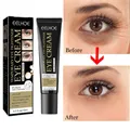 Anti Dark Circle Eye Bags Eye Cream Whitening Lightening Vc Cream Wrinkle Removal Serum Eyes Firming