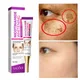 Niacinamide Whitening Freckle Cream Effectively Removes Melasma Lightens Black Spots Acne Marks