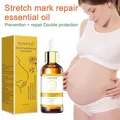 Stretch Marks Remover Essential Oil Skin Care Treatment Cream For Stretch Mark Removal Maternity