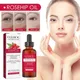 30ml Organic Rosehip Seed Oil For Face Pure Cold Pressed Facial Oil Natural Moisturizing Skin Care