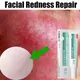 Instant Facial Redness Repair Cream Soothing Red Blood Rosacea Treatment Improve Sensitive Skin Anti