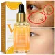 Vitamin C Remove Dark Spots Serum Whitening Freckles Fade Melanin Retinol Anti-wrinkle Essence