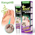 OKE YEHB-Pommade pour les Pieds Crème de Soins des Odeurs Crème Topique pour la Peau