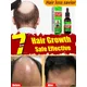 Fast Hair Growth for Men Hair Loss Hereditary Seborrheic Alopecia Treatment Oil for Hair Growth