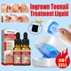 Nail Fungus Laser Treatment Device Effective Serum Nail Correction Recover Oil Pain Reliever Nail