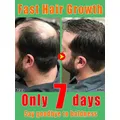 Hair growth essential oil treat hair loss baldness and various hair problems rapid hair growth in