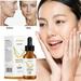 EJWQWQE Salicylic Oil Control Elimination And Repair Essence Liquid Can Weaken Marks And Close Mouth And Shrink 30ml