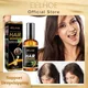 EELHOE Hair Growth Ginger Essential Treatment Scalp Dry Frizz Damaged Hair Anti Hair Loss Hair Care