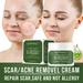 SUMDUINO TeaTree Creamï¼ŒWrinkle Cream To Eye Bags Eye Wrinkles Compact Whitening 50g Skin Care